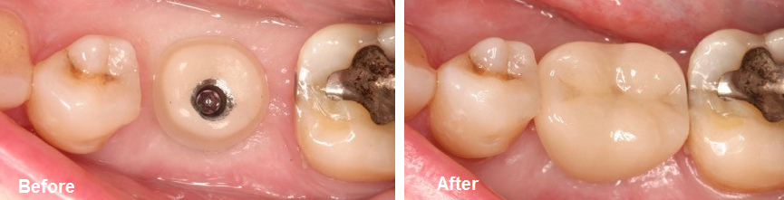 before and after