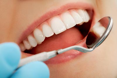 Akron’s Choice for Comprehensive Dental Exams Understanding the Health of Your Smile